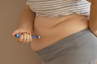 Tirzepatide Weight Loss Naples FL